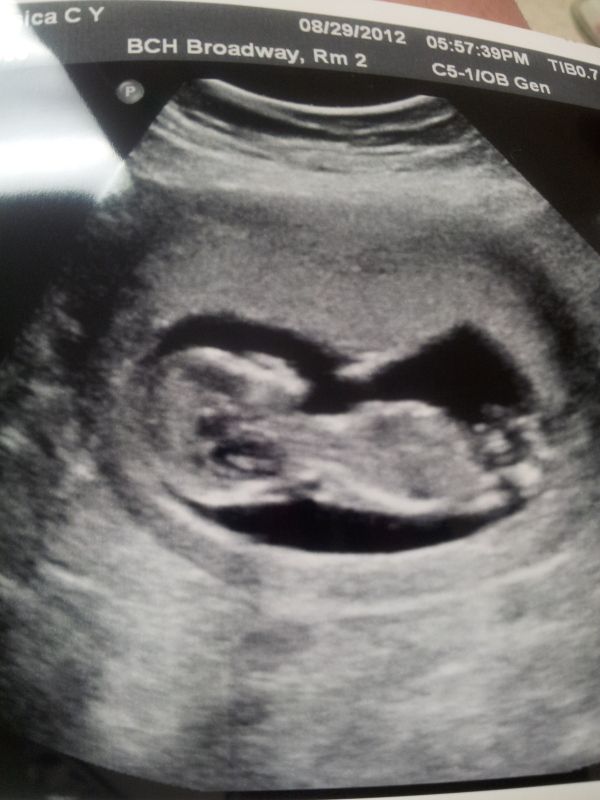 My Ultrasound